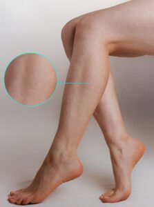 Vancouver Star Laser Centre